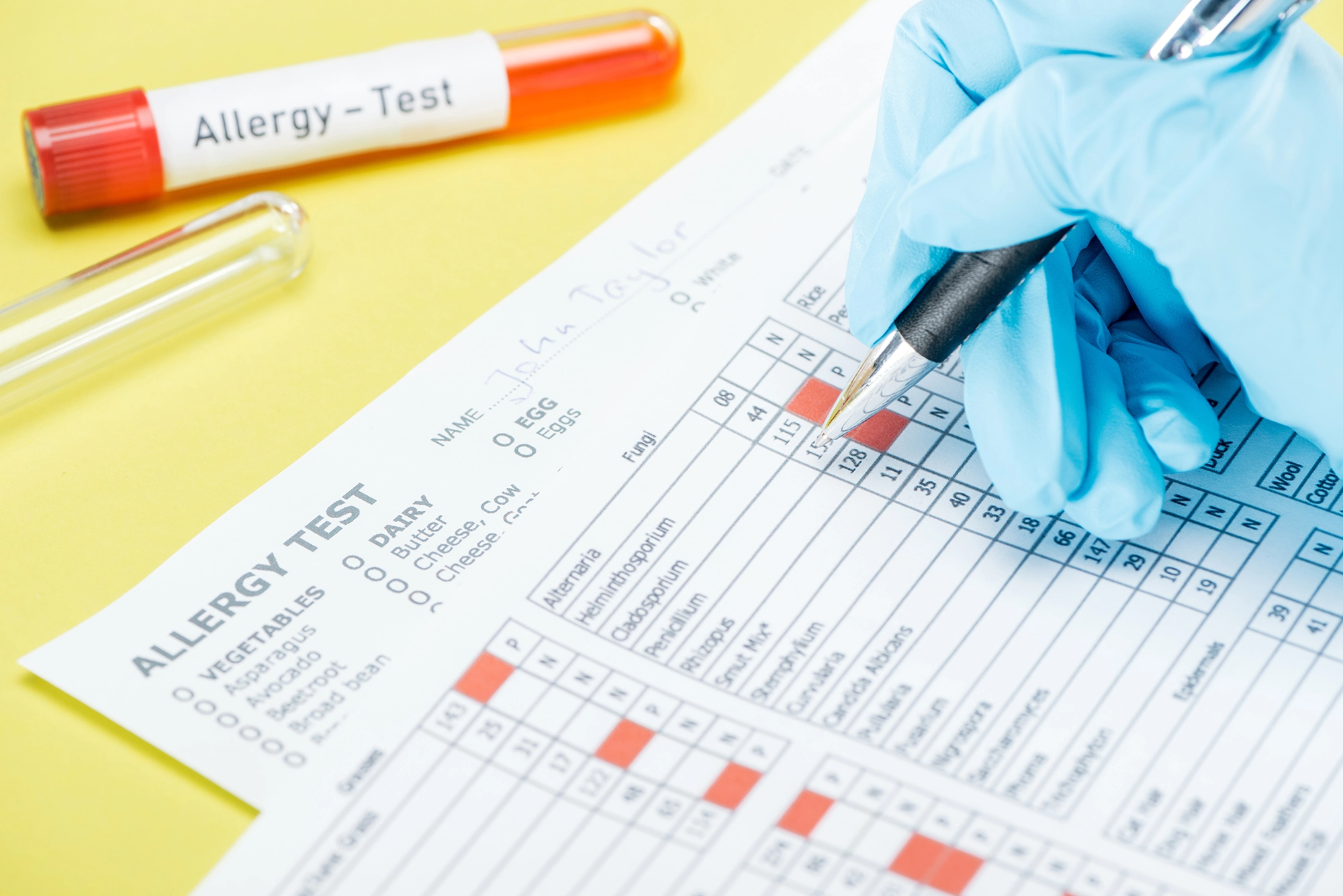 Allergy chart