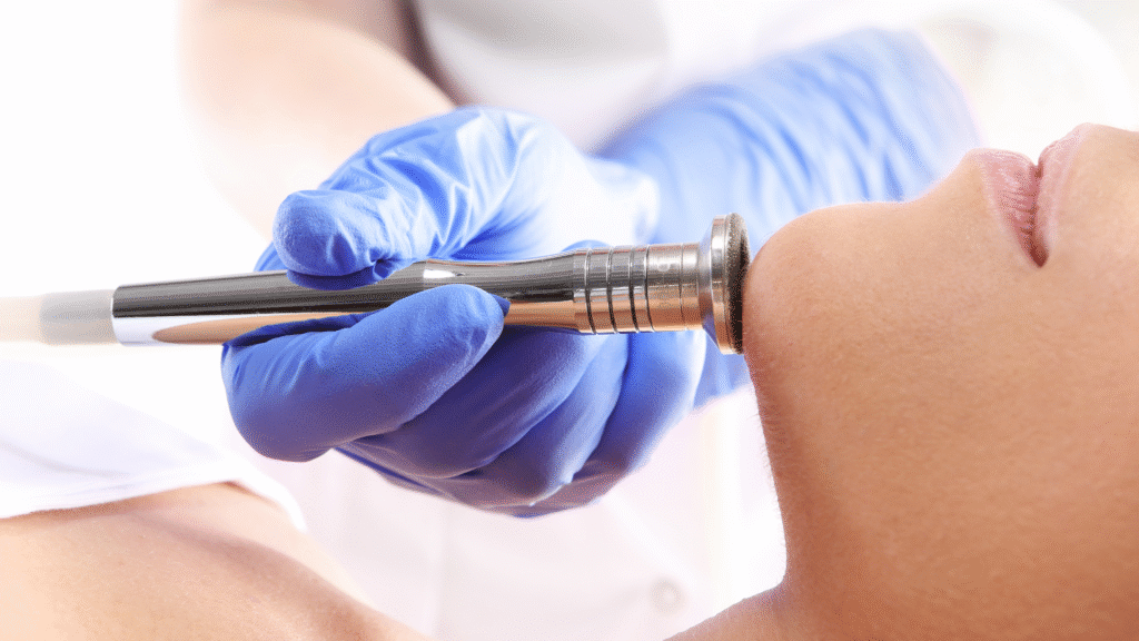 microdermabrasion in Lawrenceville GA